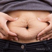 Sering Banget Disamakan, Ternyata Ini Lho Bedanya Selulit dan Strech Mark, Ladies!