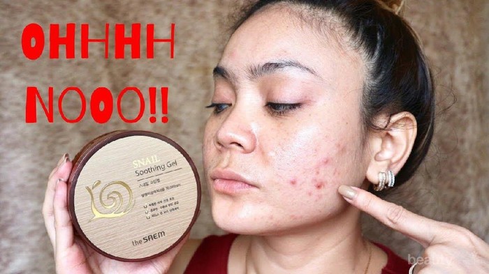 Skincare Milikmu Mengandung Snail? Ini Manfaatnya untuk Kecantikan!