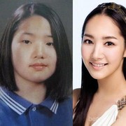 Siapa Saja Artis Korea yang Menurut Kamu Melakukan Operasi Plastik?