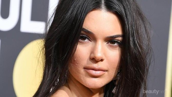 Jerawat Tak Kunjung Hilang? Cepat Coba 4 Rekomendasi Krim Jerawat Murah dan Berkualitas Ini!