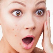 Hah, Bawang Putih Bisa Mengurangi Jerawat?