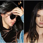 Ternyata Ini Cara Menghilangkan Jerawat yang Dilakukan oleh Kendall Jenner, Mudah dan Ampuh!