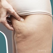 Hempas Selulit dengan Cara Ampuh Berikut Ini