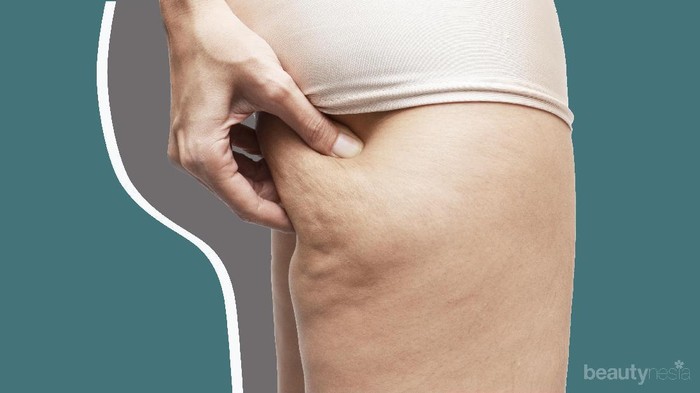 Hempas Selulit dengan Cara Ampuh Berikut Ini