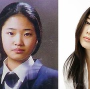 Sebelum dan Sesudah Operasi Plastik, Hasil Wajah 4 Artis Korea Ini Bikin Terkejut!