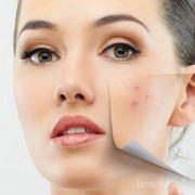 #FORUM Rekomendasi Masker Wajah Untuk Menyamarkan Noda Hitam Bekas Jerawat