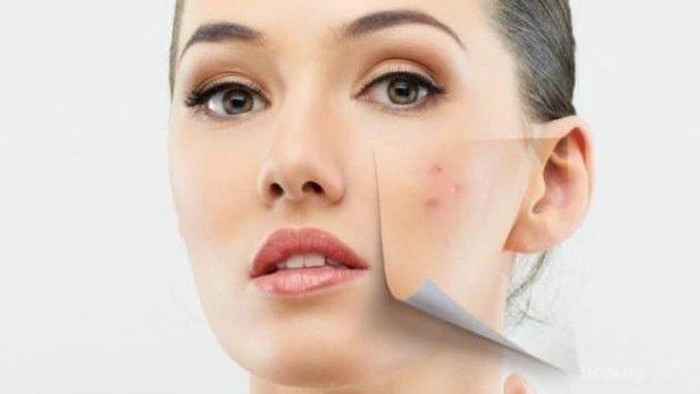 #FORUM Rekomendasi Masker Wajah Untuk Menyamarkan Noda Hitam Bekas Jerawat