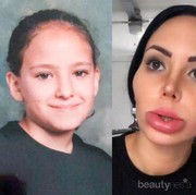 #FORUM Duh! Perempuan Ini Kecanduan Operasi Plastik! Begini Wajahnya Sekarang..