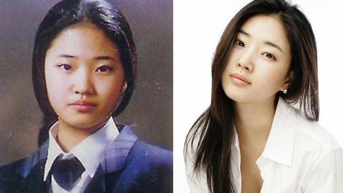 Ternyata Ini 5 Fitur Wajah yang Dianggap Ideal di Negara Korea dan Banyak Jadi Contoh Operasi Plastik