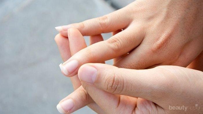 Jangan Buru-Buru Dipotong, Ikuti Cara Mudah Memperbaiki Kuku Patah Berikut Ini!