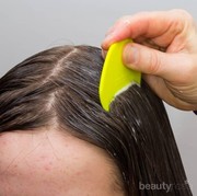 Bagaimana Cara Mengatasi Kutu Rambut??? Ada yang Tau??