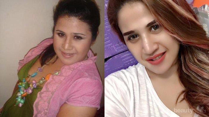 Bikin Pangling, Ternyata Dawiyah Lakukan Diet Ini Hingga Sukses Turun Berat Badan Hingga 29 Kg