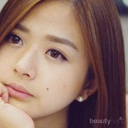 #FORUM Punya Tahi Lalat Itu, Berbahaya Enggak Sis??