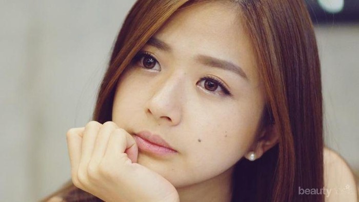 #FORUM Punya Tahi Lalat Itu, Berbahaya Enggak Sis??