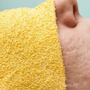 #FORUM Apa Produk yang efektif untuk Menghilangkan Luka dan Bekas Jerawat??