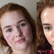 Mending ke klinik kecantikan atau coba-coba beli skincare?