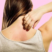 Obat Panu yang Ampuh???