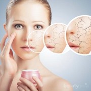 4 Cara Jitu Merawat Kulit yang Kering dengan Bahan Alami!