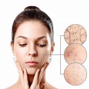 Kulit Kamu Mengalami 5 Hal Ini? Sekarang Waktunya Ganti Produk Skincare!