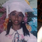 #FORUM Super Mencengangkan! Gadis Ini Dulu Kulitnya Kusam Sekarang Bikin Pangling! Rahasianya Adalah..