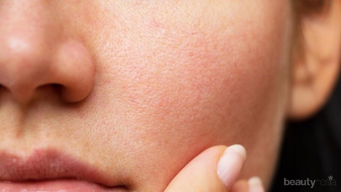 Yuk Lebih Diperhatikan, Ini Kesalahan yang Bikin Pori-pori Wajah Jadi Makin Besar