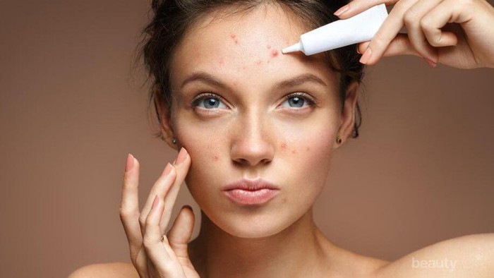 Bisa Deteksi Penyakit, Ini Arti Letak Jerawat pada Wajah