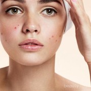 #FORUM Bener Gak Sih Gorengan Bisa Membuat Wajah Jerawatan?