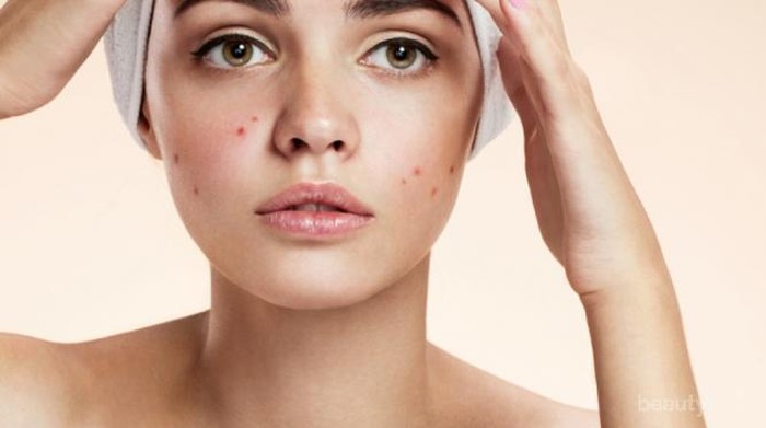 #FORUM Bener Gak Sih Gorengan Bisa Membuat Wajah Jerawatan?