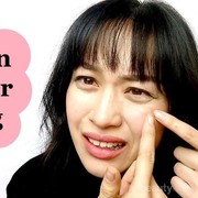 Purging atau Gak Cocok Sama Produk. Bagaimana Cara Membedakannya???