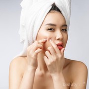 Hati-hati, 5 Kebiasaan Buruk Ini Bisa Picu Jerawat Lho Ladies!