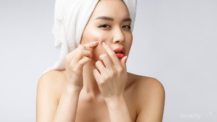 Hati-hati, 5 Kebiasaan Buruk Ini Bisa Picu Jerawat Lho Ladies!