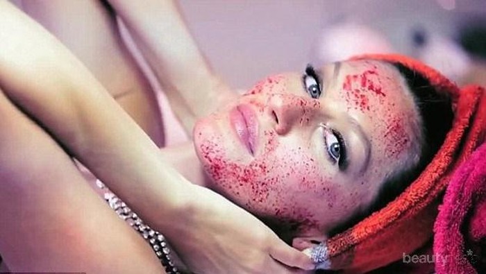 Agar Tampak 5 Tahun Lebih Muda, Kamu Berani Melakukan Vampire Facial ala Seleb Hollywood?