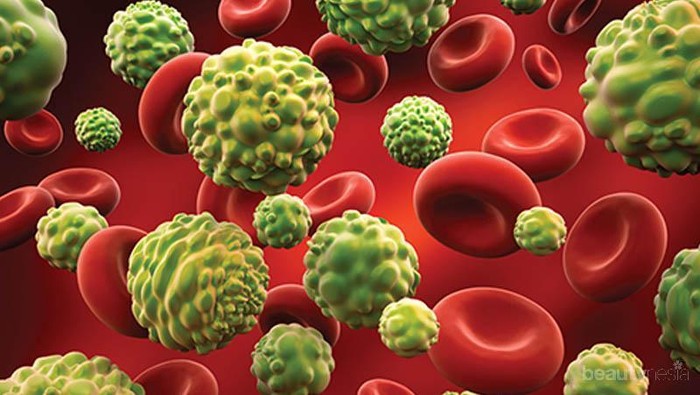 Waspadai! 8 Gejala Kanker Ini Sering Diabaikan