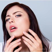 Hilangkan Komedo di Dagu dengan Tahapan Berikut Ini!