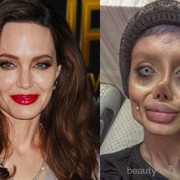 Menurut Kalian Melakukan Operasi Plastik Itu, Yes or No?