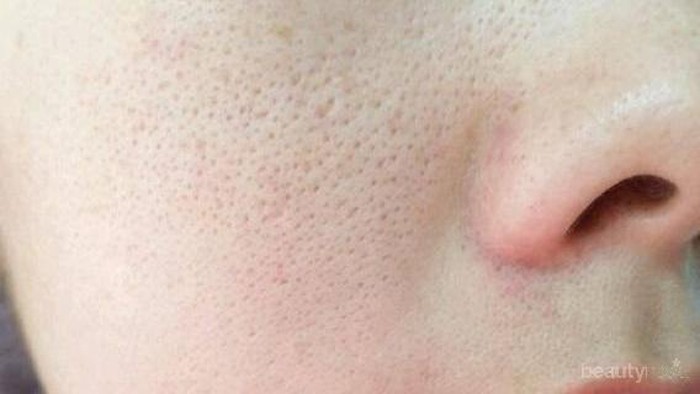 #FORUM Rekomendasi Skincare Korea yang Bisa Mengecilkan Pori-pori #FORUM Rekomendasi Skincare Korea yang Bisa Mengecilkan Pori-pori