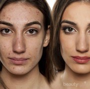 #FORUM Rekomendasi Foundation dibawah 100 ribu yang Punya Daya Coverage Tinggi