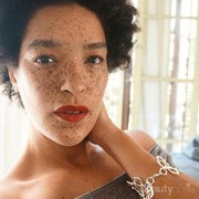 So Inspiring! Deretan Influencer Ini Berani Tampil Percaya Diri dengan Bintik Hitam di Wajah