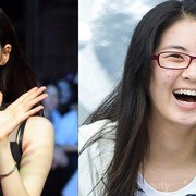 Waduh! Para Kpop Idol Ini Juga Pernah Punya Masalah Jerawat yang Serius!