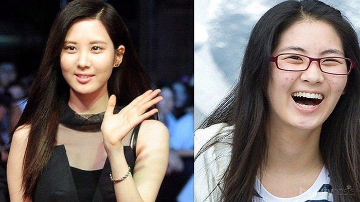 Waduh! Para Kpop Idol Ini Juga Pernah Punya Masalah Jerawat yang Serius! Waduh! Para Kpop Idol Ini Juga Pernah Punya Masalah Jerawat yang Serius!