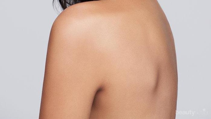 Cobain Produk Baru Ini yuk, Acnes Soap Bar Untuk Mengatasi Jerawat Punggung