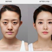 #FORUM Kalau Kamu Diberi Kesempatan untuk Operasi Plastik, Bagian Mana yang ingin Kamu Ubah?