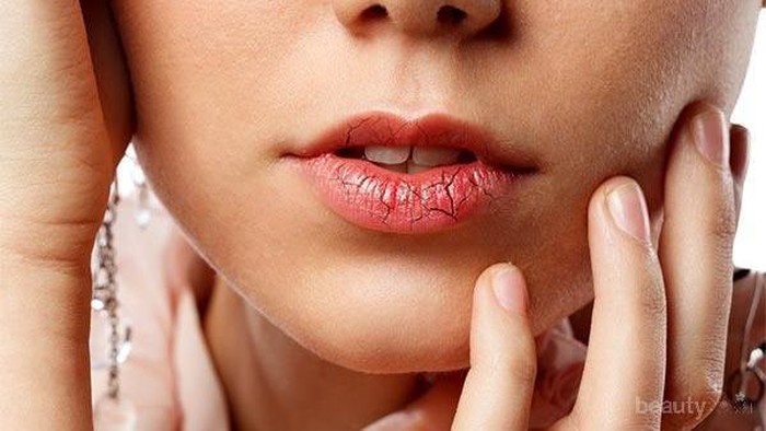 #FORUM Ada yang Tau Cara Menghilangkan Bibir Pecah-Pecah?