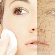 #FORUM Bagaimana Cara Mengatasi Masalah Kulit Kering karena AC?