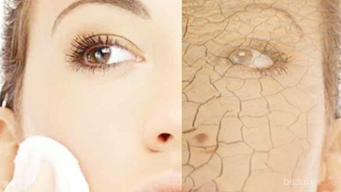 #FORUM Bagaimana Cara Mengatasi Masalah Kulit Kering karena AC?