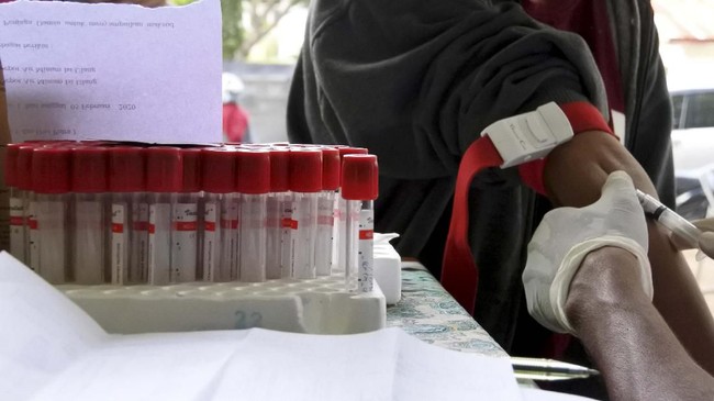 Kepala Satgas Percepatan Penanganan Corona mengimbau pemerintah daerah menyusun protokol uji laboratorium bekerja sama dengan Kementerian Kesehatan.