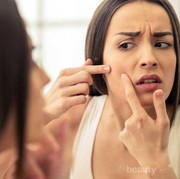 Lebih Aman Untuk Kulit, 4 Bahan Alami Ini Bisa Jadi Obat Jerawat yang Ampuh Lho!