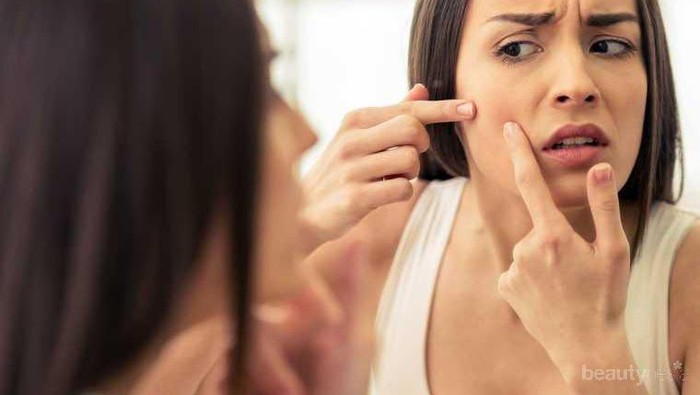 Lebih Aman Untuk Kulit, 4 Bahan Alami Ini Bisa Jadi Obat Jerawat yang Ampuh Lho!