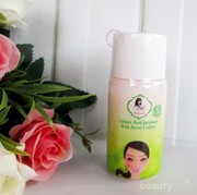 Murah Meriah Di Bawah 15K, Ada yang Pernah Coba Purbasari Lotion Anti Jerawat?? Beneran Bisa Mengurangi Jerawat?