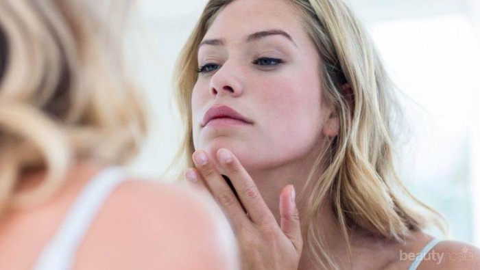 Salep VS Obat Minum untuk Jerawat, Mana yang Lebih Ampuh? Ini Dia Jawabannya!